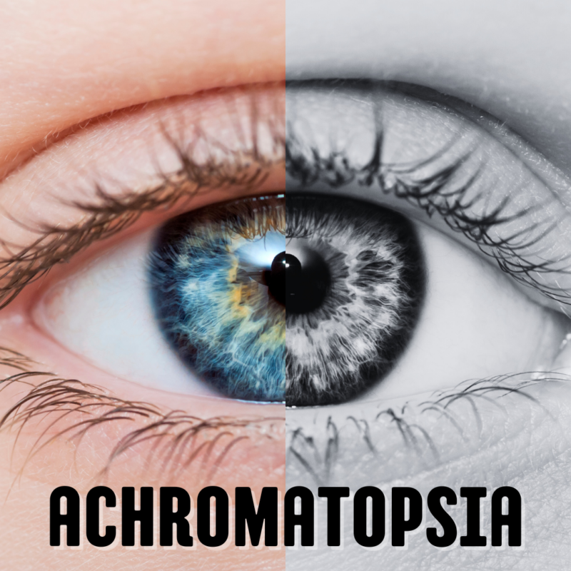 An eye is divided into two halves. The left half is in full color, showing a blue iris with highlights. The right half is in grayscale, depicting the same iris without color. The word 'ACHROMATOPSIA' is written below in bold, black letters. This illustrates the condition of achromatopsia, where individuals see in shades of gray