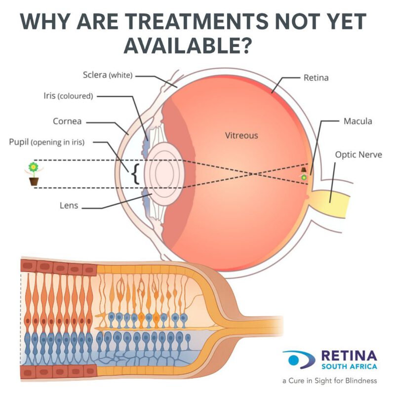 Educational diagram of the human eye anatomy, showing labelled parts including retina, macula, optic nerve, vitreous, sclera, iris, cornea, pupil, and lens. Includes a detailed cross-section of the retina to illustrate its complex structure and explain why treatments for blindness are challenging.