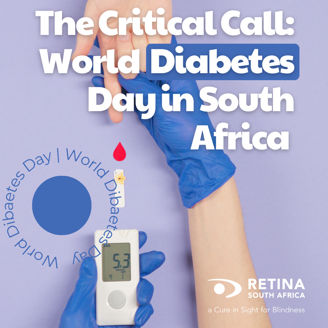 Promotional image for World Diabetes Day. A person wearing blue medical gloves uses a glucose meter to check another person's blood sugar level, which reads 5.3. A red drop of blood is visible above the tested finger. In the background, a circular graphic repeats the phrase “World Diabetes Day” around a central blue dot. Main text reads “The Critical Call: World Diabetes Day in South Africa.” Retina SA logo appears in the bottom right corner