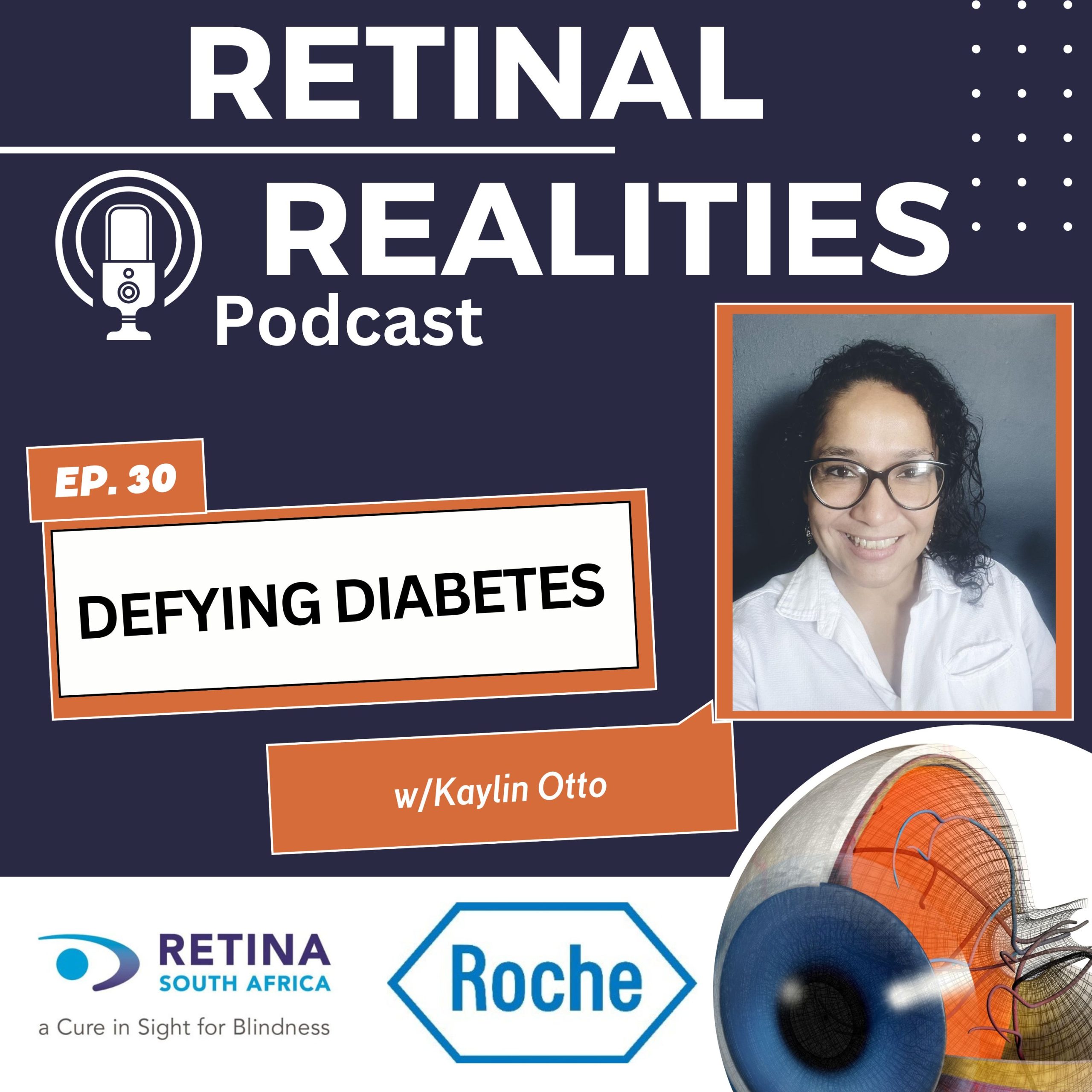 Graphic promoting the “Retinal Realities Podcast” episode 30 titled “Defying Diabetes.” The design features a blue background with radiating lines, a microphone icon, and bold white text for the podcast name. A label in orange reads “EP. 30,” and a large white box contains the episode title.” At the bottom, are logos for Retina SA and Roche. An orange banner on the right includes the text “w/ Kaylin Otto.